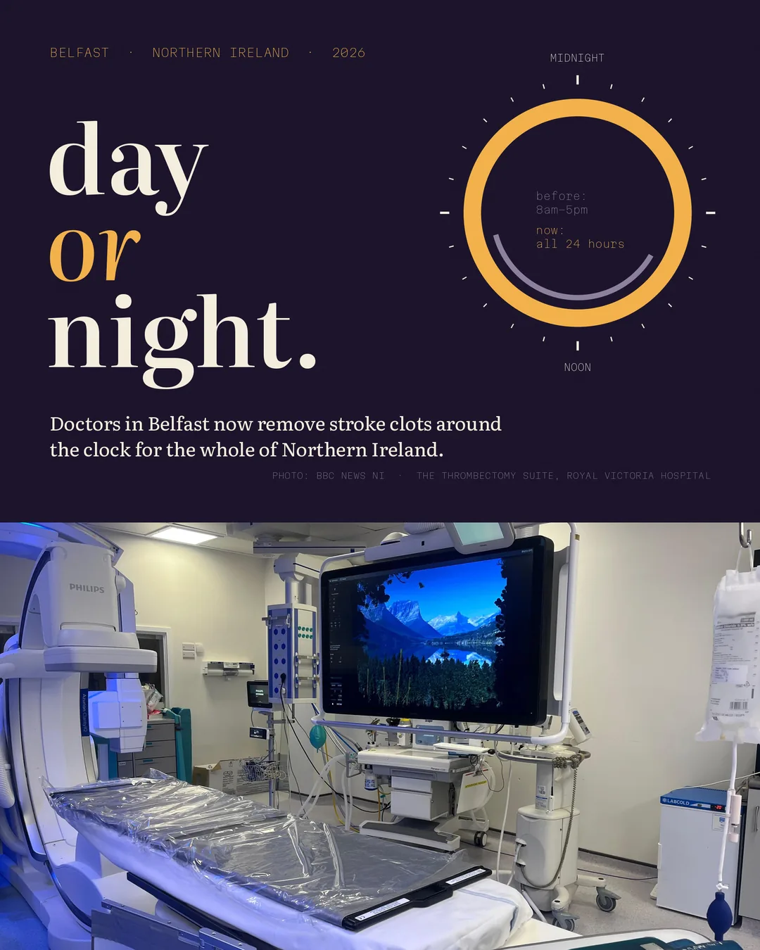 Northern Ireland: stroke clot removal now 24/7